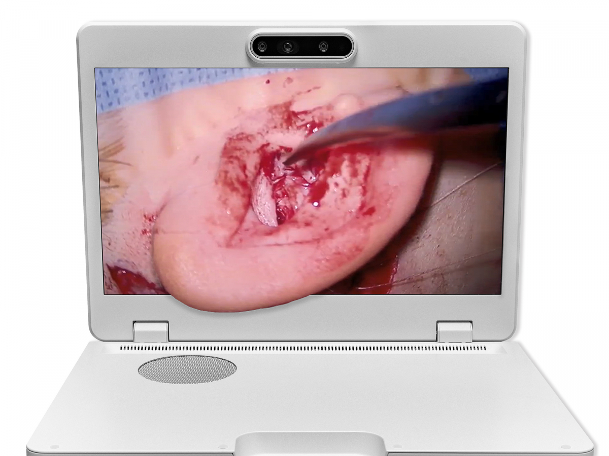 达擎之＂Heads-up 3D显微手术显示系统＂，整合4K裸眼3D显示及眼球追踪系统，具备快速追踪人眼移动位置功能，减轻医师长时间维持固定姿势的负担，让医师能有更宽广清晰的3D立体视野及更舒适的姿势来执行手术。